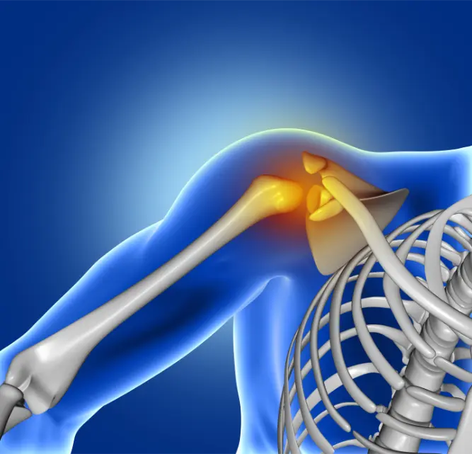 7 nejčastějších příčin bolesti ramene