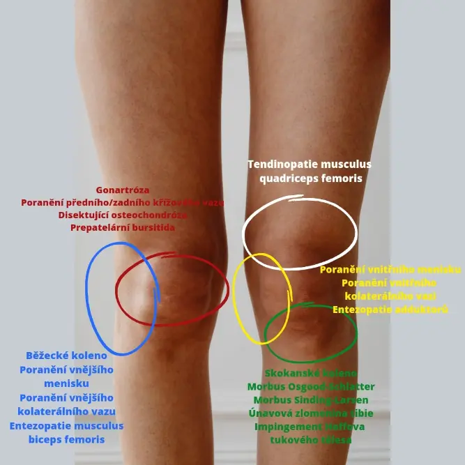 Příčiny bolesti kolene